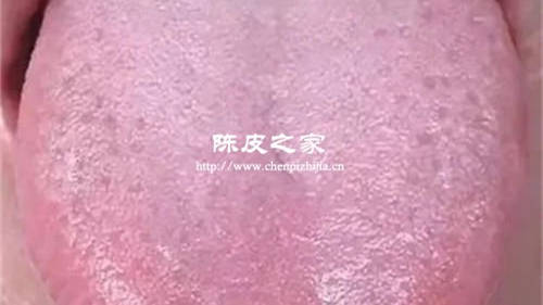 喝了陳皮枸杞雪梨舌苔變厚了