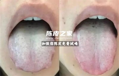 痰濕喝陳皮多長時間可以好