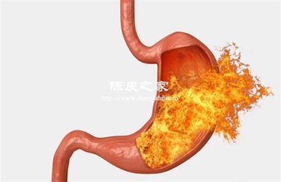 有胃火可以喝陳皮山楂水嗎