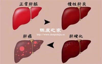 陳皮提取物在酒精性肝損傷修復(fù)中的潛力